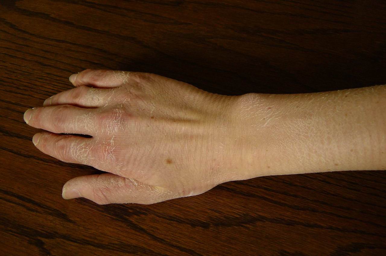 Hand1 (119K)