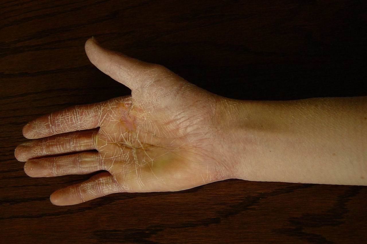 Hand2 (102K)